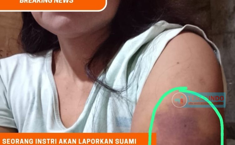  Seorang Istri  Asal Sumenep Akan Laporkan Suaminya Setelah Dianiaya Hingga Babak Belur di Bali