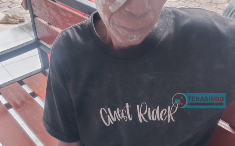 Butuh Bantuan Pemerintah, Warga Sapeken Terlunta-lunta Numpang dikoskosan Pasca Operasi 